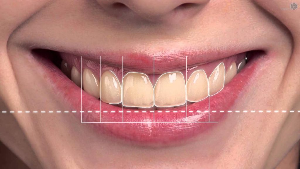Diseño de sonrisas, la técnica integral de estética dental
