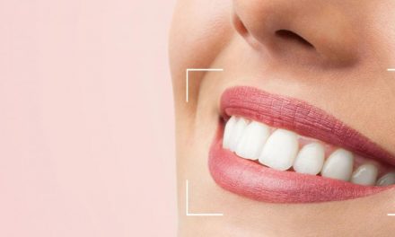 Diseño de sonrisas, la técnica integral de estética dental