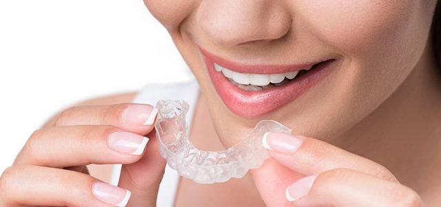La mejor opción para tu ortodoncia