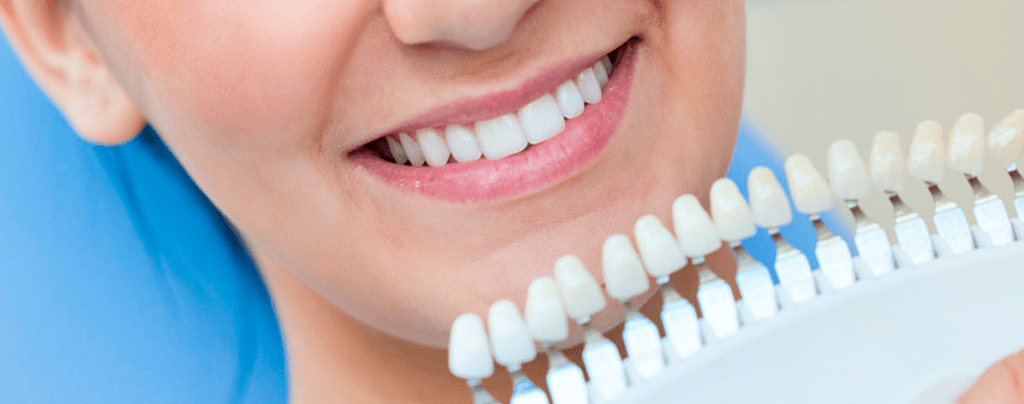 Mejora la higiene bucal con un blanqueamiento dental