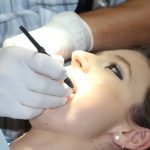 Los principales beneficios de las carillas dentales