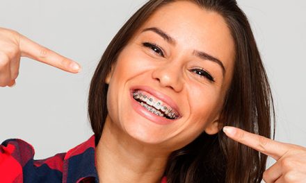 ¿Cuándo es aconsejable una ortodoncia? Luce una sonrisa perfecta